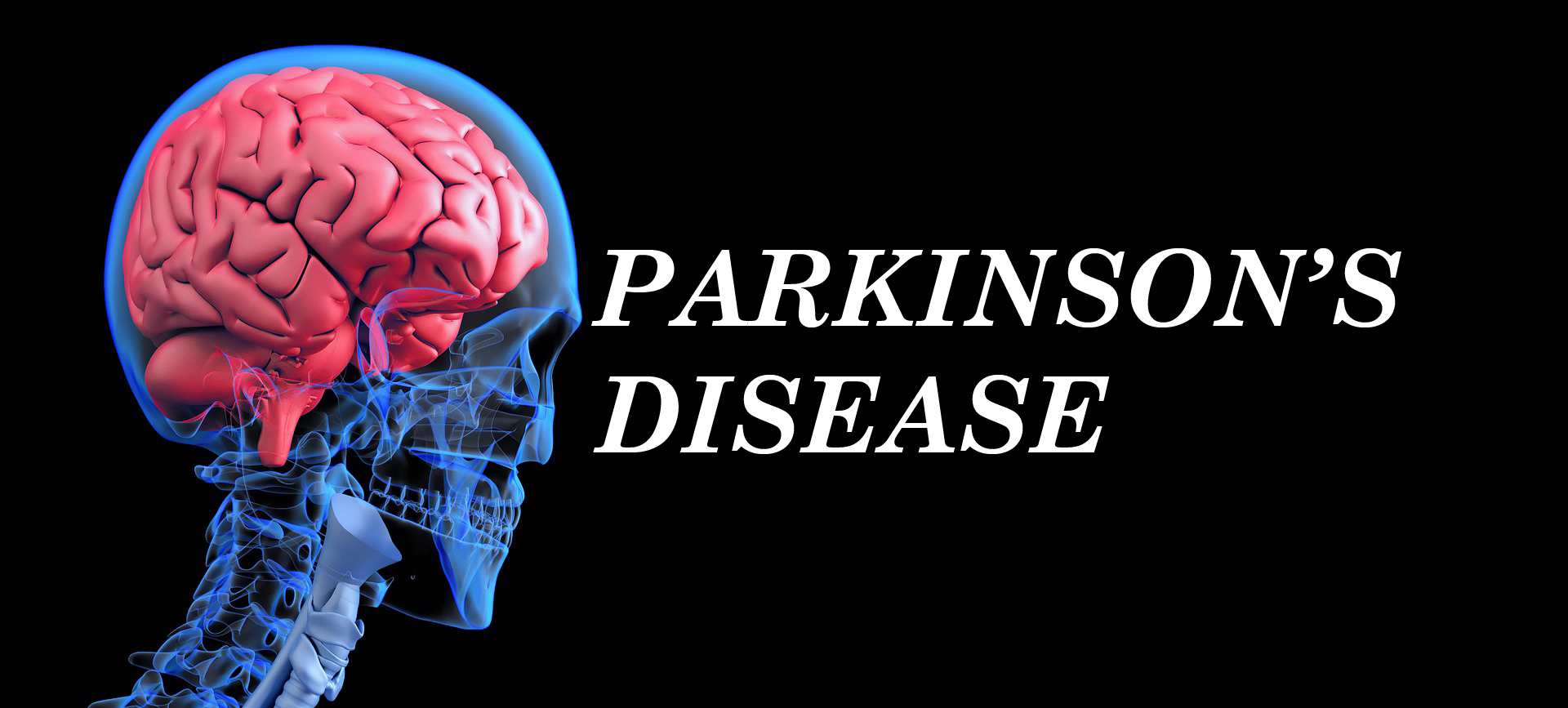 Parkinson's Disease Market